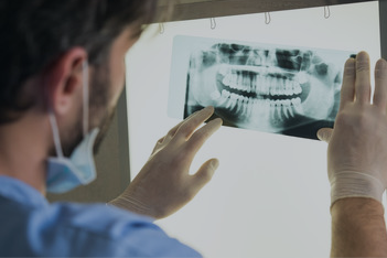 Dentist looking at X-Ray