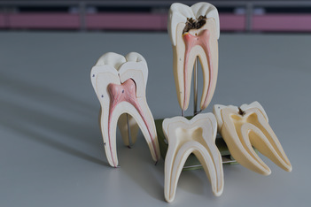 Teeth models with root canals